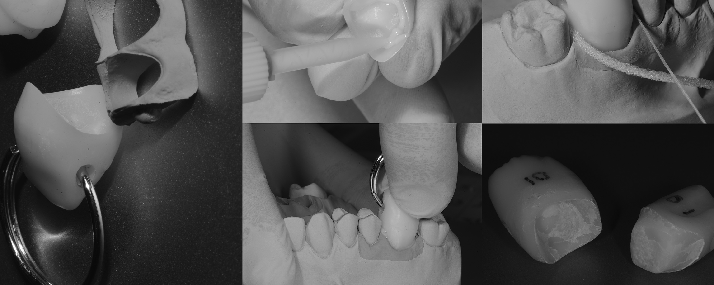 StringaCementazione_1